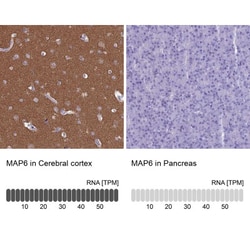 MAP6 Antibody, Novus Biologicals 25ul | Buy Online | Novus Biologicals | Fisher Scientific